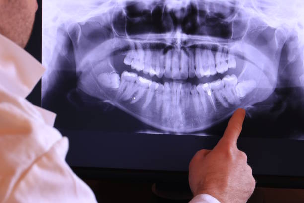 Best Emergency Treatment for Jaw Pain or Injury in Mcconnellsburg, PA